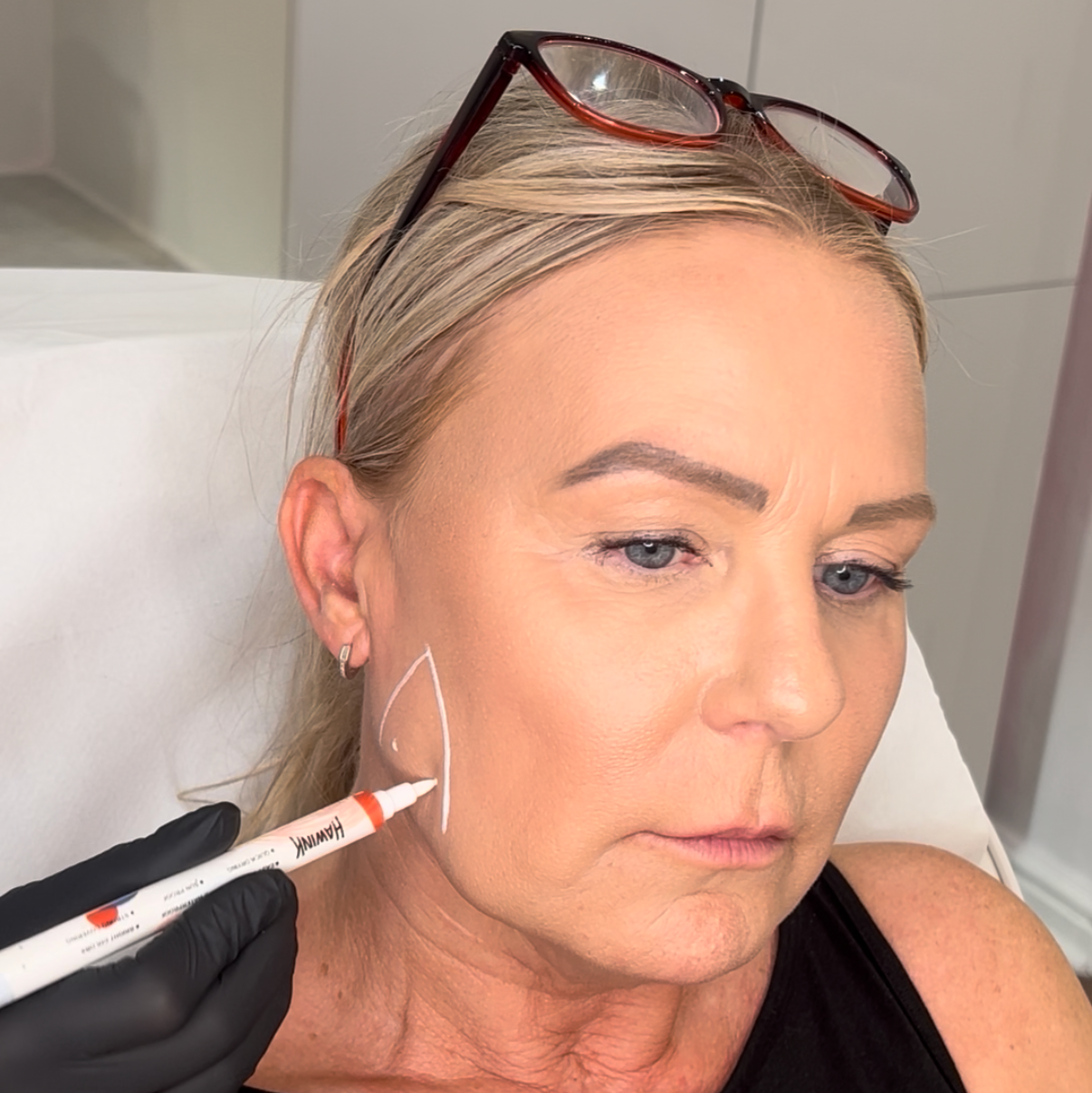 Masseter Botox & Jawline Slimming Training